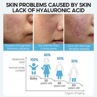 15ml Hyaluronic Acid Face Serum — image 3