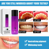30ml Teeth Whitening Liquid — image 7
